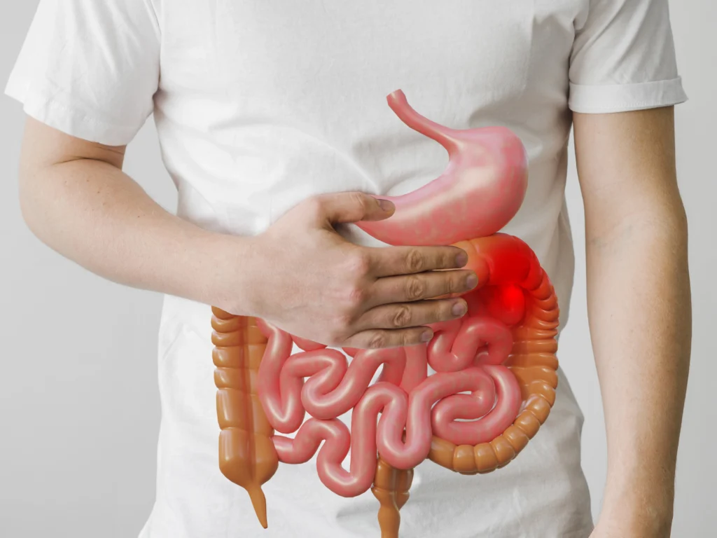 doença de Crohn