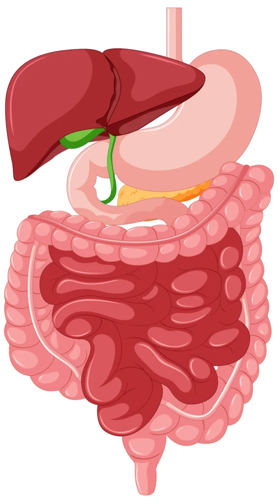 doença de Crohn